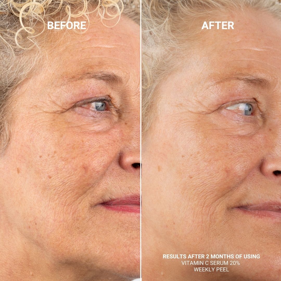 WEEKLY PEEL WITH 28% AHA & 2% BHA