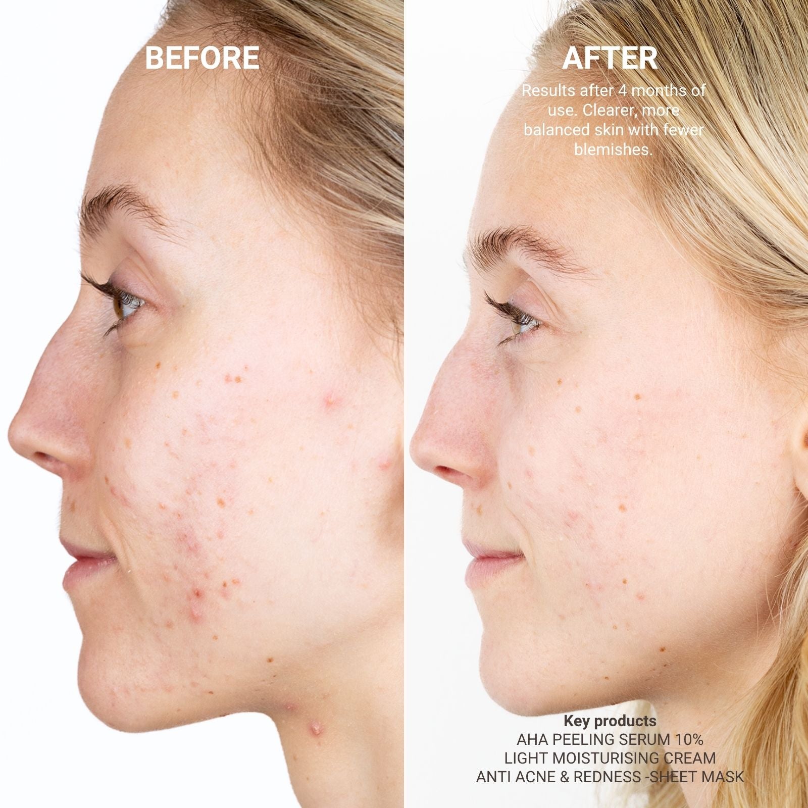 LIGHT MOISTURISING CREAM